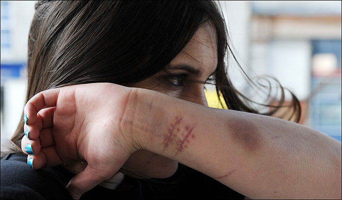 Girls harm self do why NMSU: Teens
